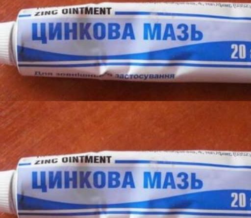 Недорогі мазі з аптеки з неймовірною силою: 4 простих засоби, про силу яких ми забули