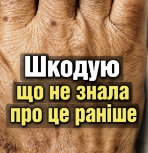 А ви вкурсі, якщо у вас на руках схожі ПЛЯМИ, це свідчить про те, що ви страждаєте від…